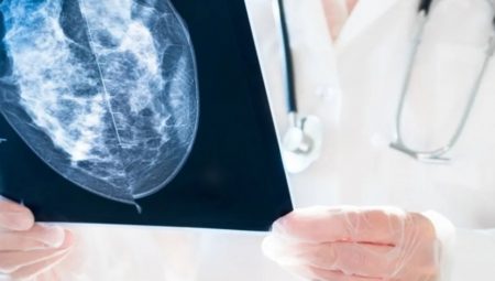 Mamografide ‘Kategori 0’ Endişesi: Risk Habercisi mi? Uzman Görüşleriyle Açıklıyoruz
