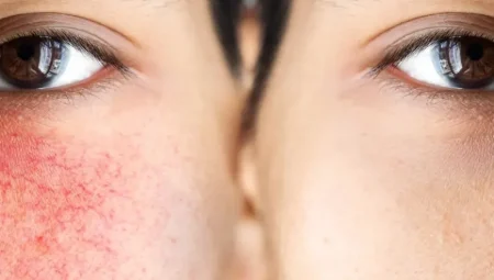 Yüzümüz Neden Daha Hassas? Sıcak Su Neden Daha Fazla Yanma Hissi Veriyor?