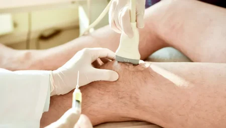 Yeni Hidrojel Yöntemi, Osteoporoz Tedavisinde 2 Haftada Çığır Açabilir