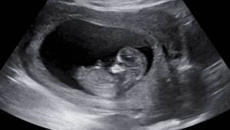 Tarihte Bir İlk: SMA’lı Çocuk, Anne Karnında Tedavi Edildi!